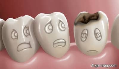 چگونه از دندان درد در دوران بارداری پیشگیری کنیم 