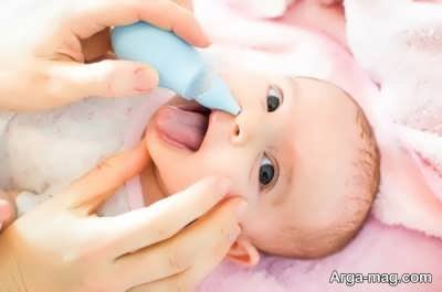 درمان گرفنگی بینی نوزادان با مکش